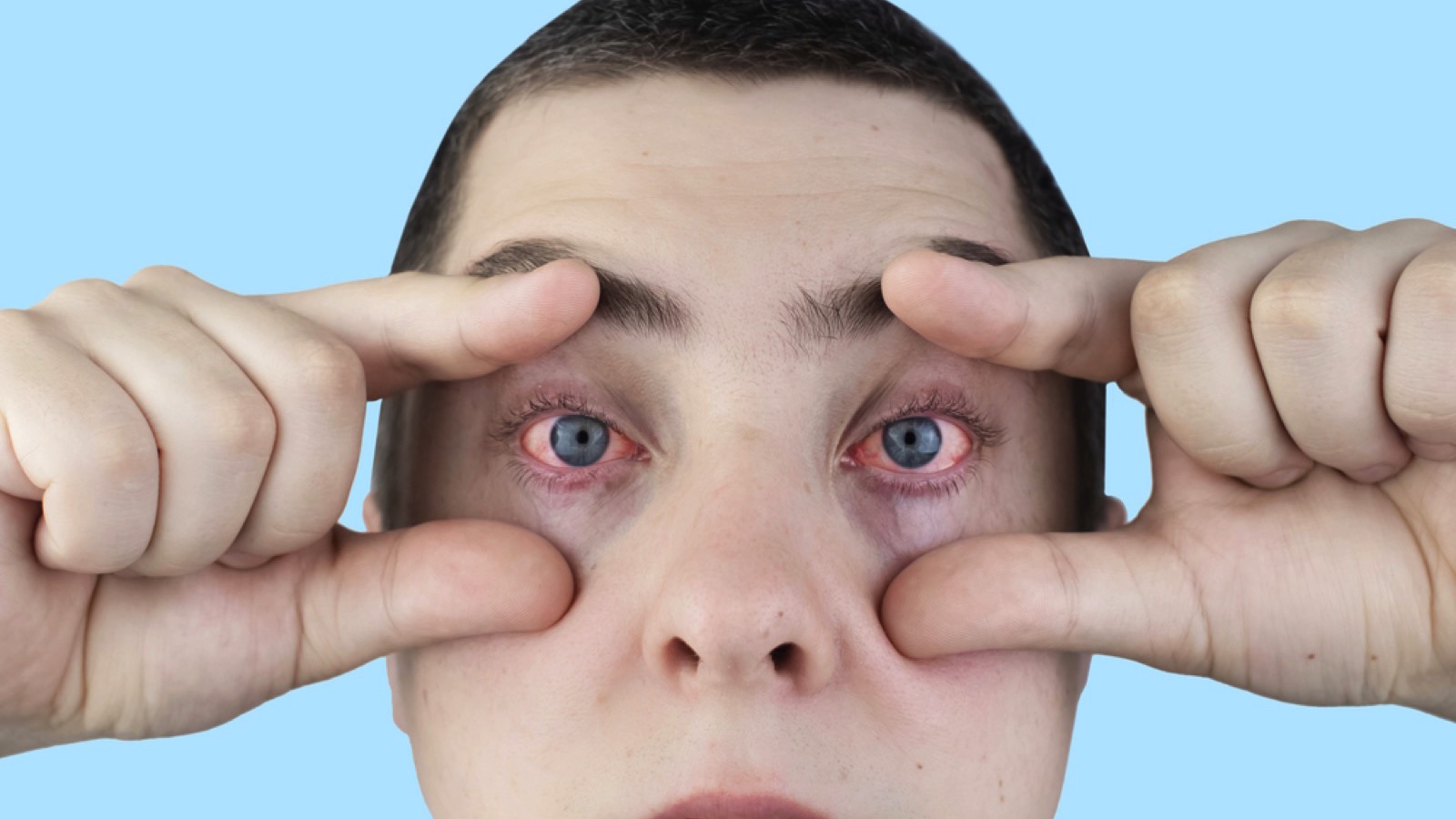 Man with red eyes